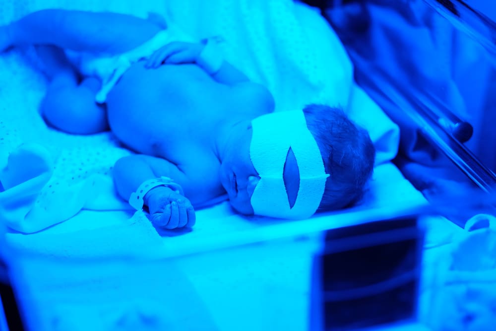 Tout Savoir Sur La Phototherapie Pour Bebe Mamans Pratiques